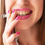 Fumo e impianti dentali